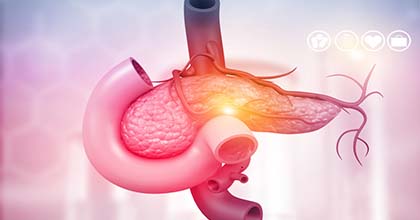 جراحة أورام البنكرياس والقنوات المرارية